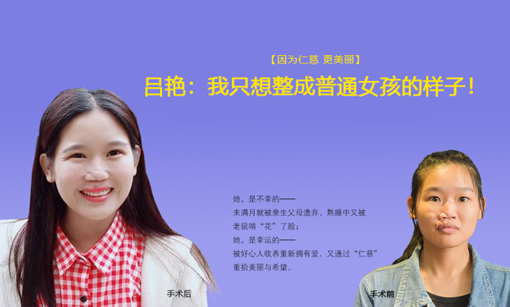 因為仁慈 更美麗|呂艷：我只想整成普通女孩的樣子！