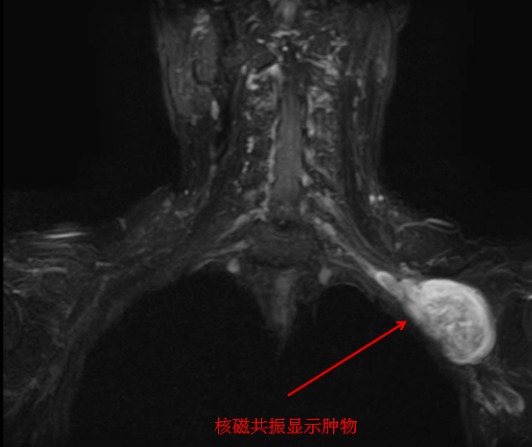 仁慈手外科