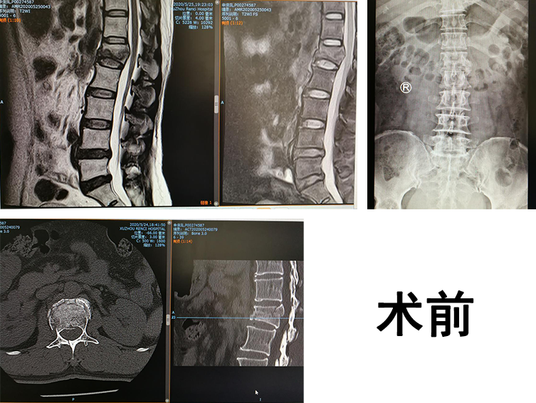 骨科機(jī)器人