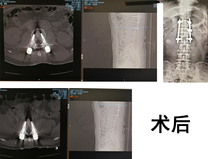 骨科機(jī)器人