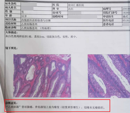 徐州仁慈醫(yī)院消化內(nèi)鏡