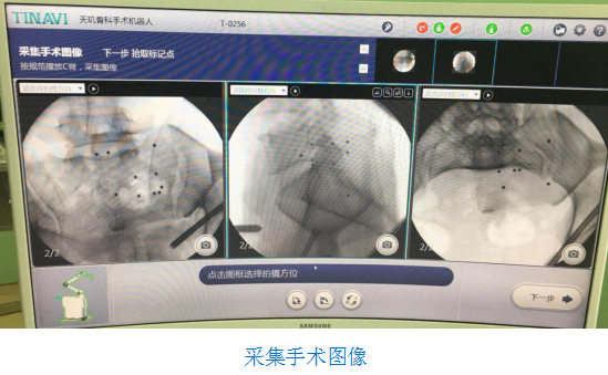 骨科機器人