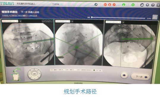 骨科機器人